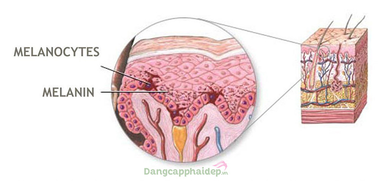 Melanin sản sinh để bảo vệ da khỏi UV, càng tiếp xúc nắng da càng sậm màu